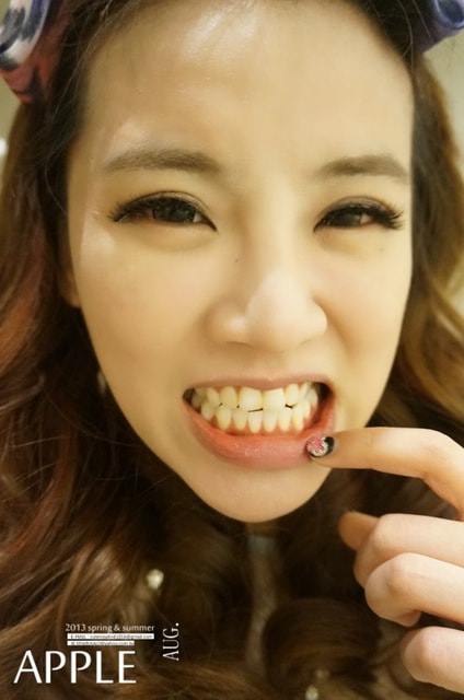 【美保】日亞美牙齒美白&美唇護理。平價優質的日系牙科診所❤