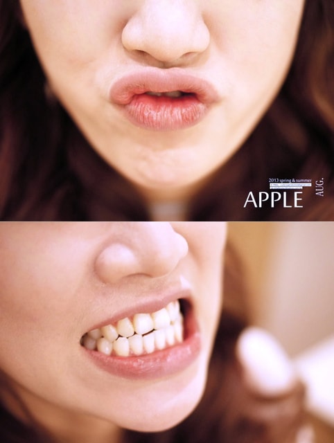 【美保】日亞美牙齒美白&美唇護理。平價優質的日系牙科診所❤