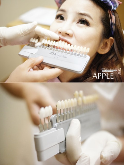 【美保】日亞美牙齒美白&美唇護理。平價優質的日系牙科診所❤