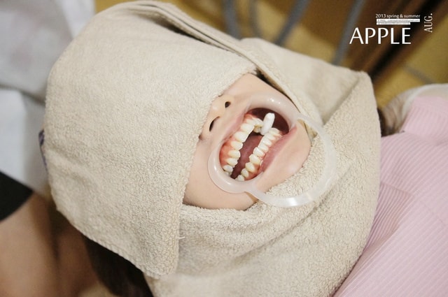 【美保】日亞美牙齒美白&美唇護理。平價優質的日系牙科診所❤