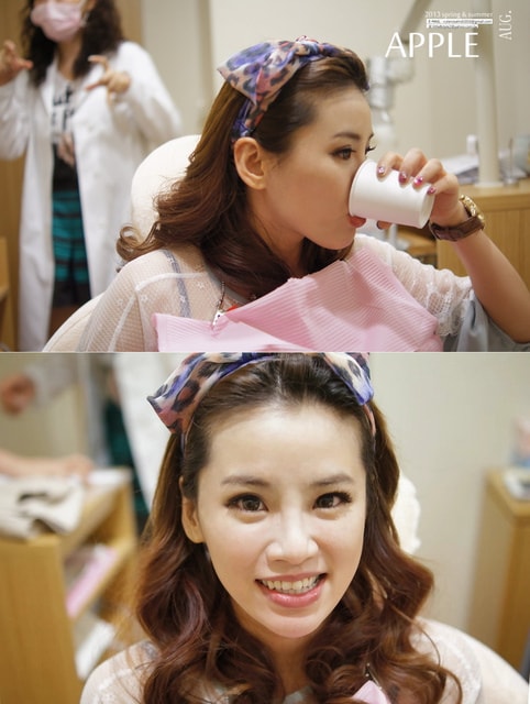 【美保】日亞美牙齒美白&美唇護理。平價優質的日系牙科診所❤