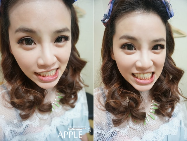 【美保】日亞美牙齒美白&美唇護理。平價優質的日系牙科診所❤