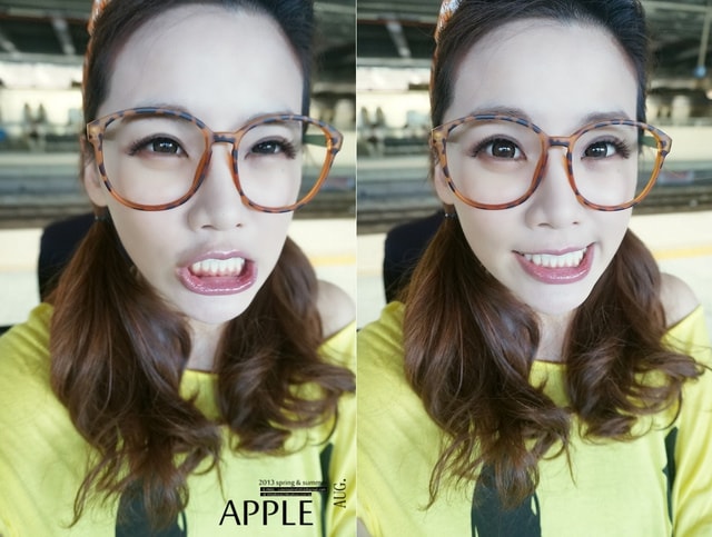 【美保】日亞美牙齒美白&美唇護理。平價優質的日系牙科診所❤