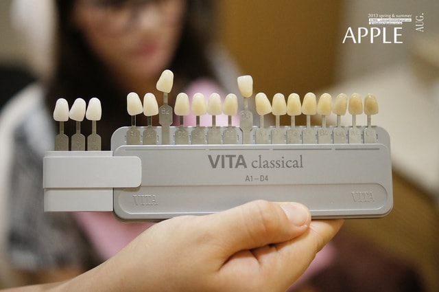 【美保】日亞美牙齒美白&美唇護理。平價優質的日系牙科診所❤