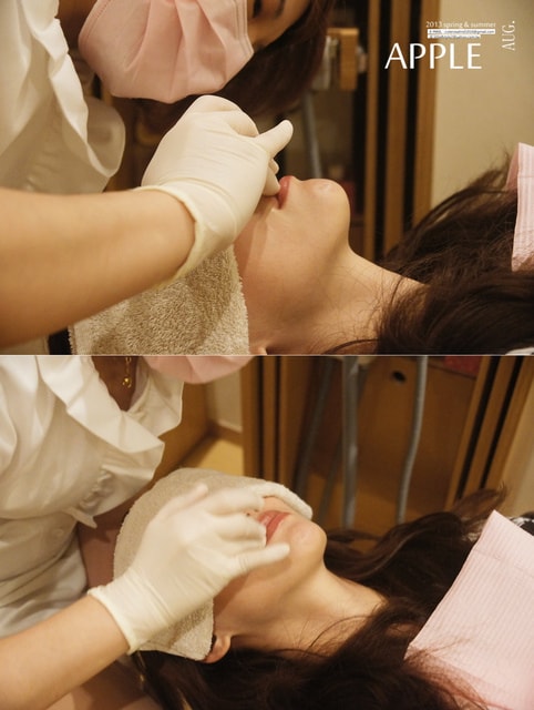 【美保】日亞美牙齒美白&美唇護理。平價優質的日系牙科診所❤