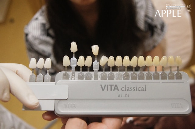 【美保】日亞美牙齒美白&美唇護理。平價優質的日系牙科診所❤