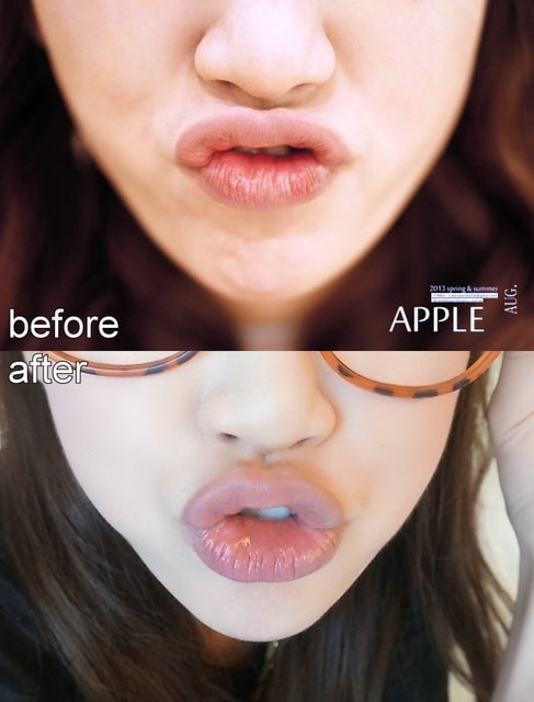 【美保】日亞美牙齒美白&美唇護理。平價優質的日系牙科診所❤