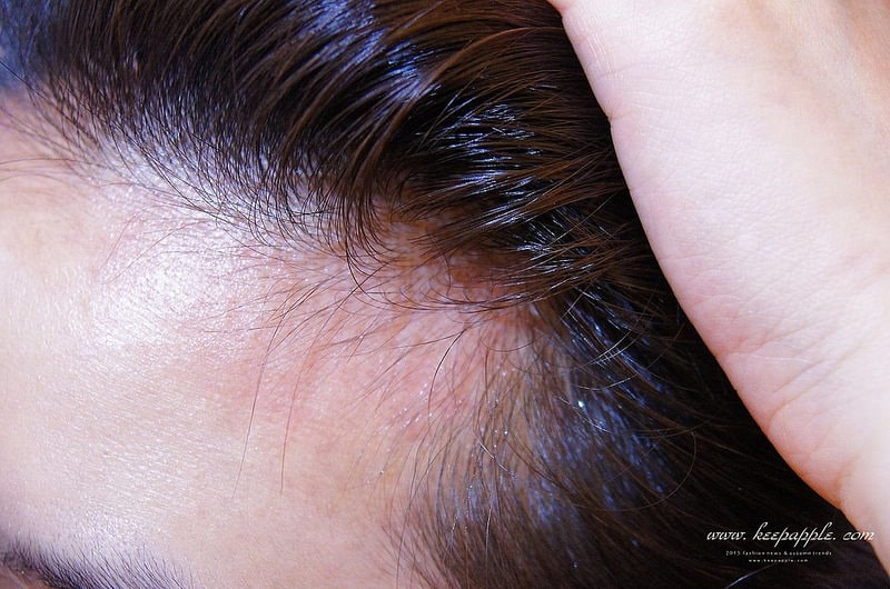 【改造】想要有韓妞般圓弧髮際線。DR.CYJ髮胜肽加強保養髮根&頭皮 - 第28張圖 DSC06107