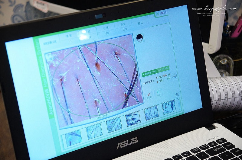 【改造】想要有韓妞般圓弧髮際線。DR.CYJ髮胜肽加強保養髮根&頭皮 - 第31張圖 DSC09977