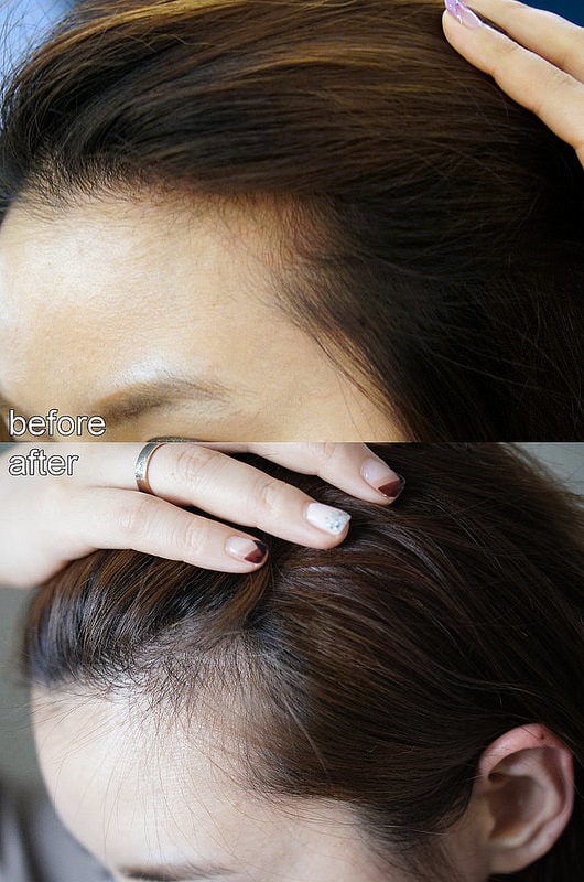 【改造】想要有韓妞般圓弧髮際線。DR.CYJ髮胜肽加強保養髮根&頭皮 - 第32張圖 比較圖一