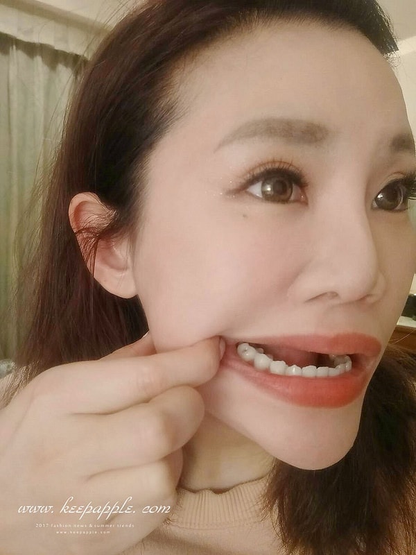 【看牙日記】我的崩牙拯救紀錄 // 台北牙醫推薦:悅庭牙醫診所/全瓷冠/3D齒雕 - 第2張圖 23223