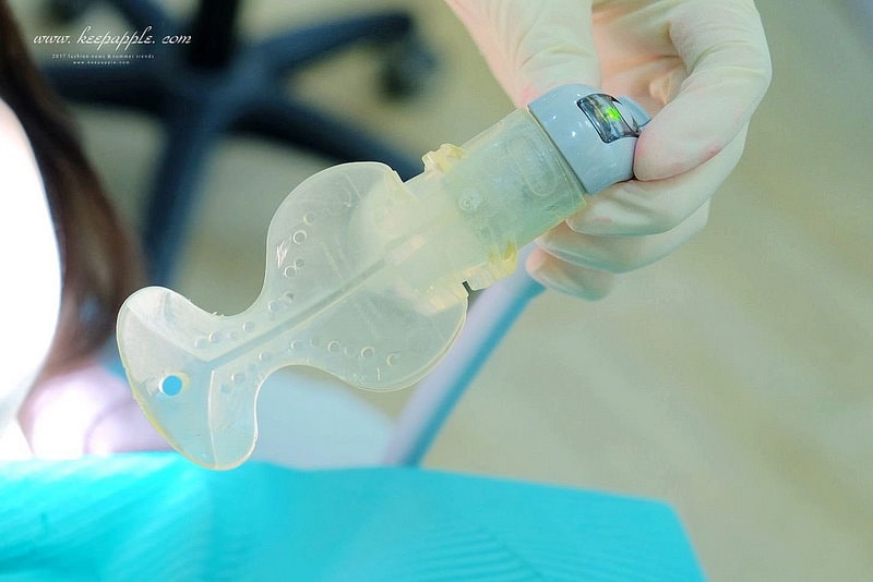 【看牙日記】我的崩牙拯救紀錄 // 台北牙醫推薦:悅庭牙醫診所/全瓷冠/3D齒雕 - 第16張圖 DSCF9731