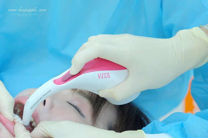 【看牙日記】我的崩牙拯救紀錄 // 台北牙醫推薦:悅庭牙醫診所/全瓷冠/3D齒雕 - 第19張圖 DSCF9765