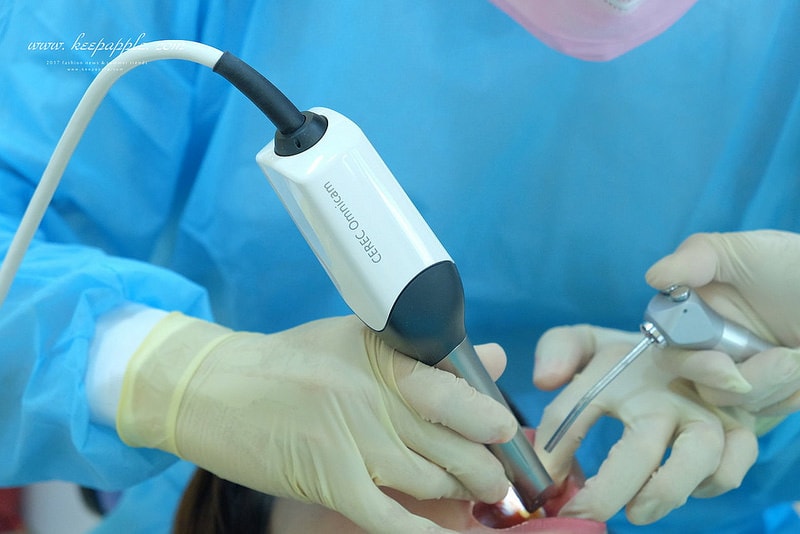 【看牙日記】我的崩牙拯救紀錄 // 台北牙醫推薦:悅庭牙醫診所/全瓷冠/3D齒雕 - 第21張圖 DSCF9775