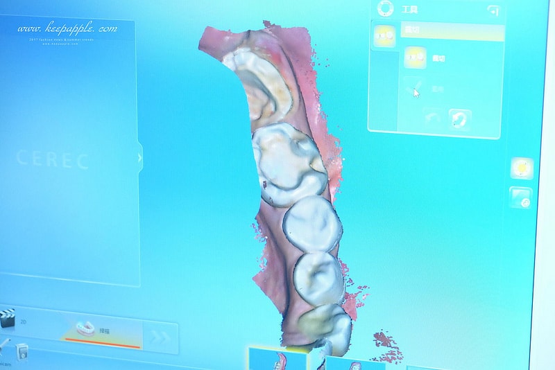 【看牙日記】我的崩牙拯救紀錄 // 台北牙醫推薦:悅庭牙醫診所/全瓷冠/3D齒雕 - 第25張圖 DSCF9794