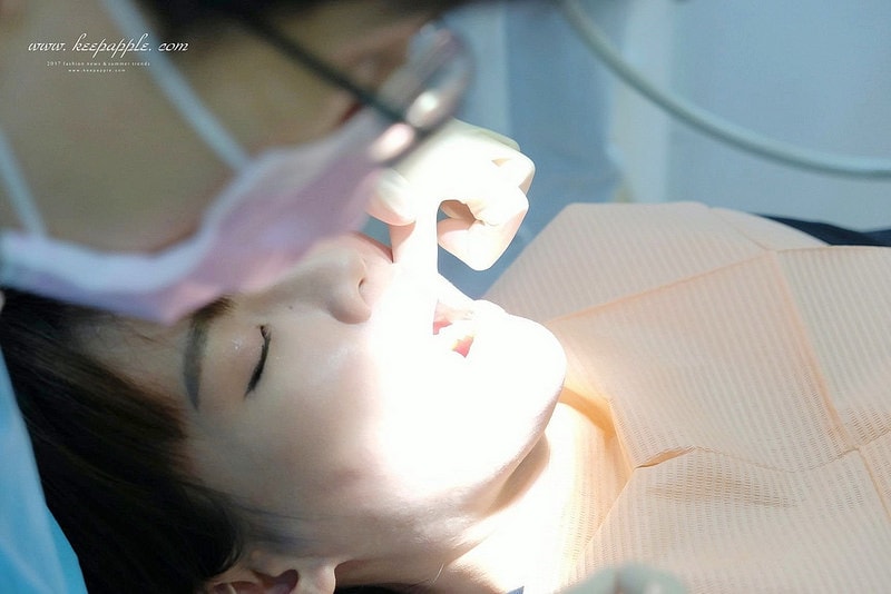 【看牙日記】我的崩牙拯救紀錄 // 台北牙醫推薦:悅庭牙醫診所/全瓷冠/3D齒雕 - 第33張圖 DSCF9923