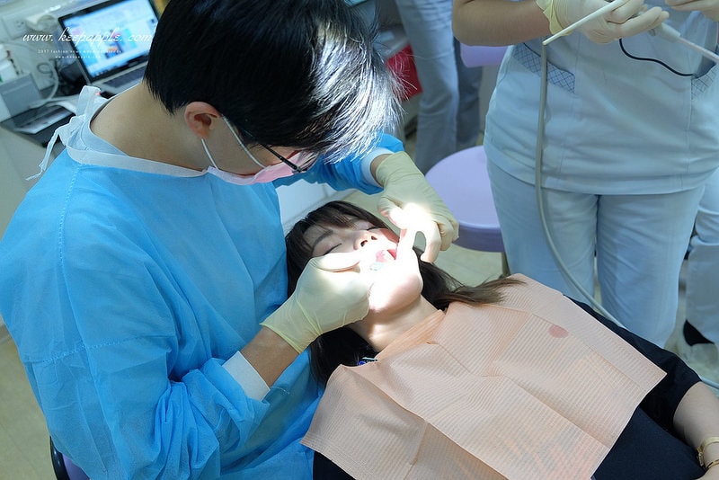 【看牙日記】我的崩牙拯救紀錄 // 台北牙醫推薦:悅庭牙醫診所/全瓷冠/3D齒雕 - 第37張圖 DSCF9945