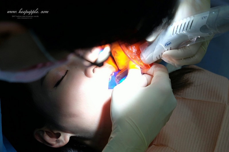 【看牙日記】我的崩牙拯救紀錄 // 台北牙醫推薦:悅庭牙醫診所/全瓷冠/3D齒雕 - 第39張圖 DSCF9973