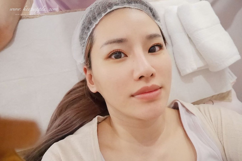 【醫美】夏日抗紅大作戰。對抗泛紅、斑點跟膚色不均的最佳幫手就是M22彩衝光 - 第26張圖 P1460534