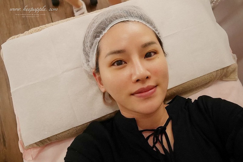 【醫美】夏日抗紅大作戰。對抗泛紅、斑點跟膚色不均的最佳幫手就是M22彩衝光 - 第38張圖 P1460742