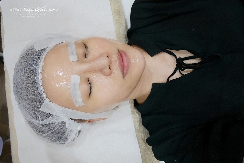 【醫美】夏日抗紅大作戰。對抗泛紅、斑點跟膚色不均的最佳幫手就是M22彩衝光 - 第40張圖 P1460753