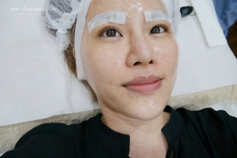 【醫美】夏日抗紅大作戰。對抗泛紅、斑點跟膚色不均的最佳幫手就是M22彩衝光 - 第43張圖 P1460768