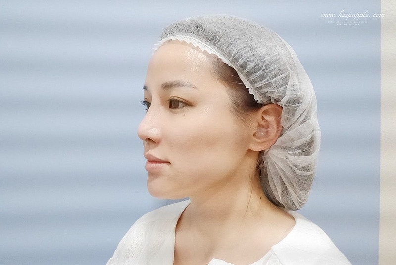 【醫美】舒顏美人幫X複合性療程。解決一直在意的臉凹問題 - 第21張圖 P1460327