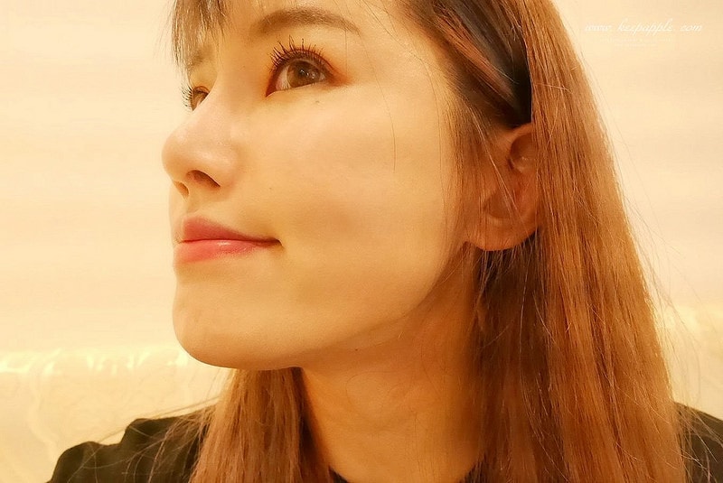 【醫美】舒顏美人幫X複合性療程。解決一直在意的臉凹問題 - 第34張圖 P1460550