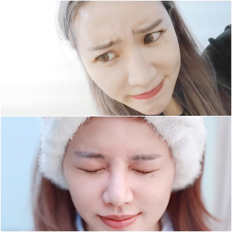 【醫美】舒顏美人幫X複合性療程。解決一直在意的臉凹問題 - 第46張圖 page2