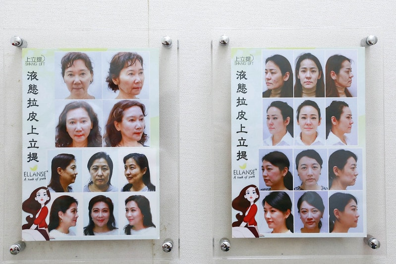 【醫美】永和皮膚科推薦 林上立醫師 少女針Ellanse洢蓮絲不只除皺還能長膠原蛋白喔!