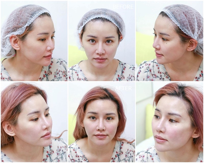 永和皮膚科推薦