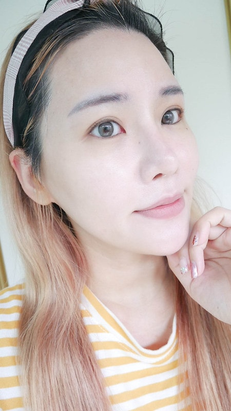 【醫美】永和皮膚科推薦 林上立醫師 少女針Ellanse洢蓮絲不只除皺還能長膠原蛋白喔!