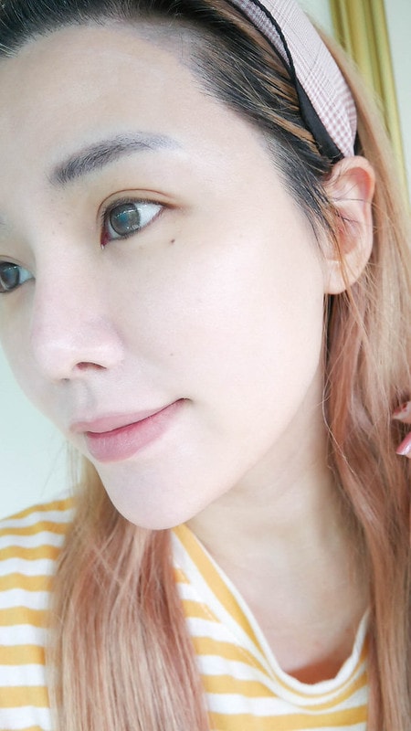 【醫美】永和皮膚科推薦 林上立醫師 少女針Ellanse洢蓮絲不只除皺還能長膠原蛋白喔!