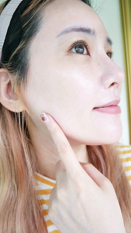 【醫美】永和皮膚科推薦 林上立醫師 少女針Ellanse洢蓮絲不只除皺還能長膠原蛋白喔!