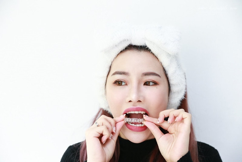 【家電】2019歐樂B沖牙機推薦。可攜式高效活氧沖牙機~讓牙套妹的牙齒保養更輕鬆! - 第3張圖 歐樂B沖牙機