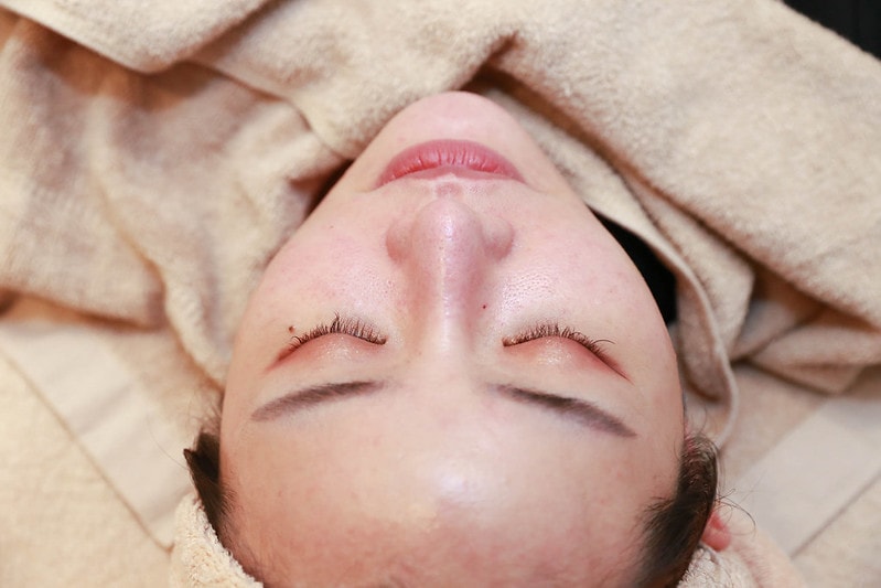 【醫美】Nice Clinic耐斯診所 。水飛梭(海菲秀)+探索皮秒一起來 給我煥然一新晶透好膚質 - 第11張圖 IMG_4404