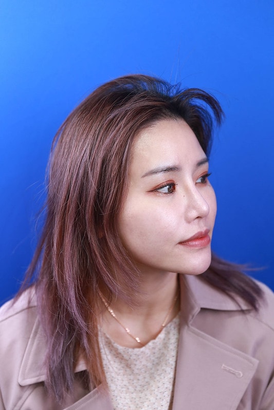 【美容】一次做了皮秒+藍寶石雷射+童顏點滴。輕醫美當道-佐登微爾健康管理醫美診所 - 第20張圖 IMG_6637