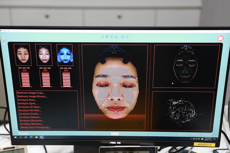 【美容】一次做了皮秒+藍寶石雷射+童顏點滴。輕醫美當道-佐登微爾健康管理醫美診所 - 第24張圖 IMG_6654