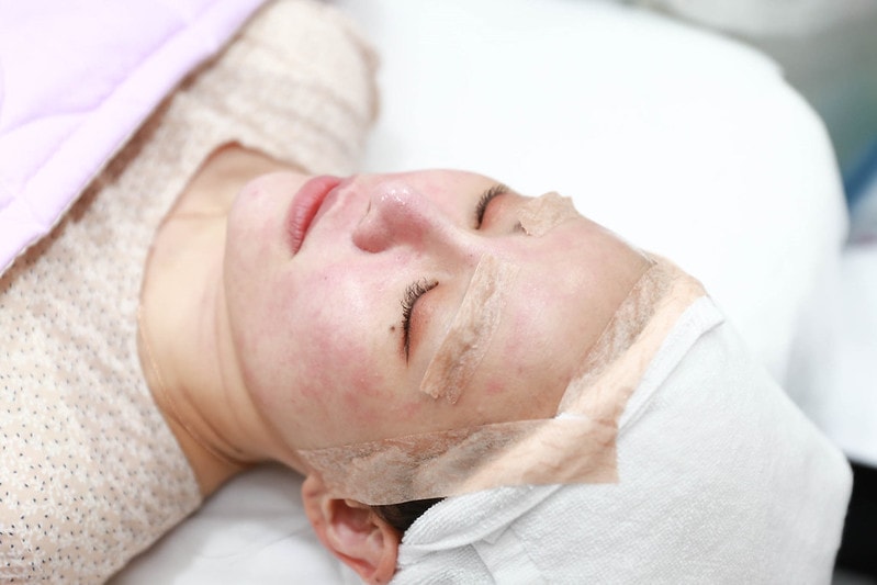 【美容】一次做了皮秒+藍寶石雷射+童顏點滴。輕醫美當道-佐登微爾健康管理醫美診所 - 第42張圖 IMG_6822