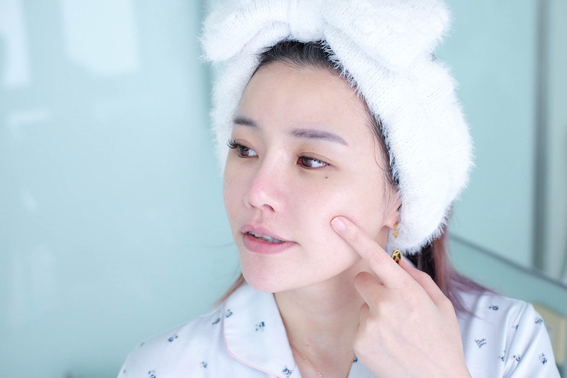 【美容】一次做了皮秒+藍寶石雷射+童顏點滴。輕醫美當道-佐登微爾健康管理醫美診所 - 第51張圖 DSCF6154