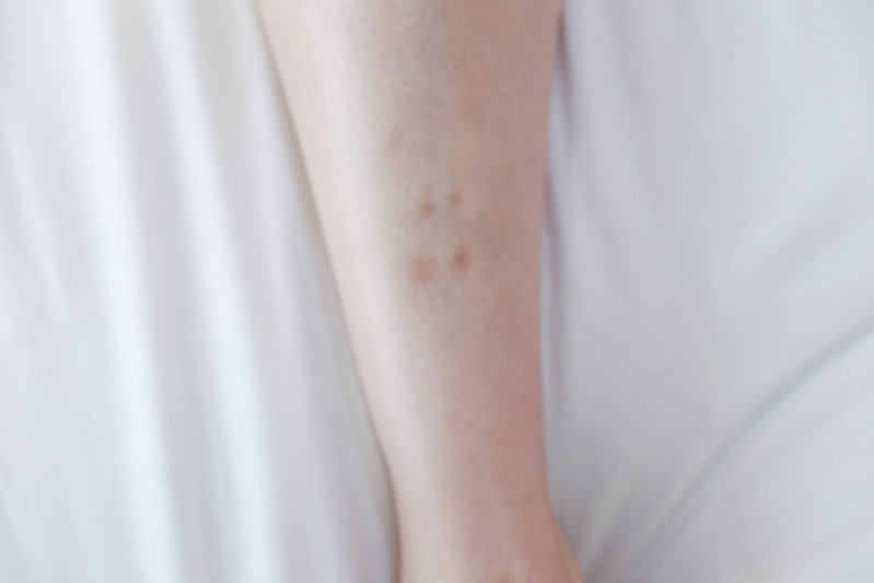 【美體】實測均勻膚色+改善身體暗沉的居家好朋友。Emma1997 美白身體勻嫩霜&身體潤膚霜 - 第19張圖 IMG_5385