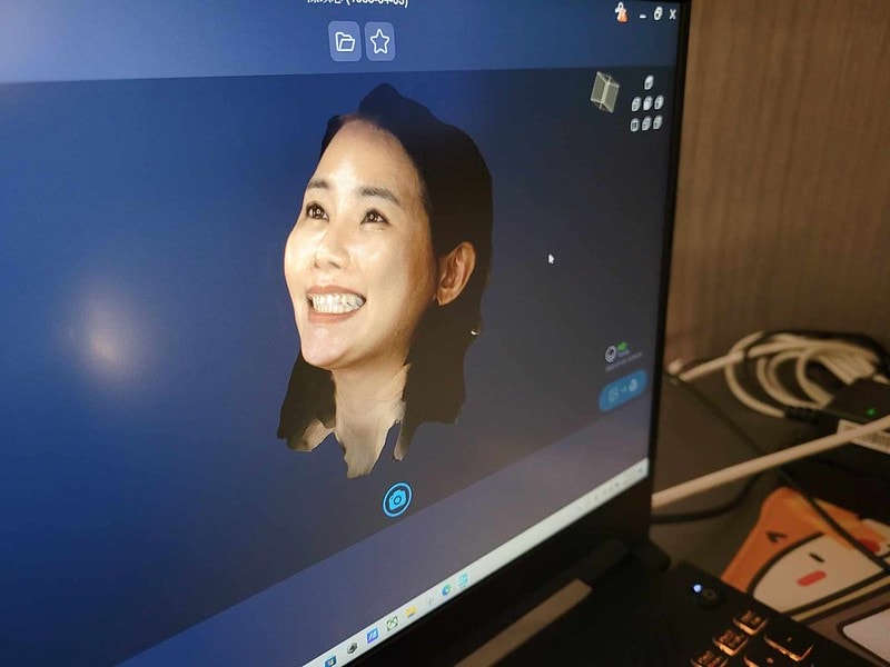 【美白貼片】有關於我的牙齒🦷終於鼓起勇氣做了陶瓷貼片 為什麼要做?注意事項? (板橋蒔美牙醫 薛聖儒醫生) - 第16張圖 434112382_402481049085622_3361413606397012184_n