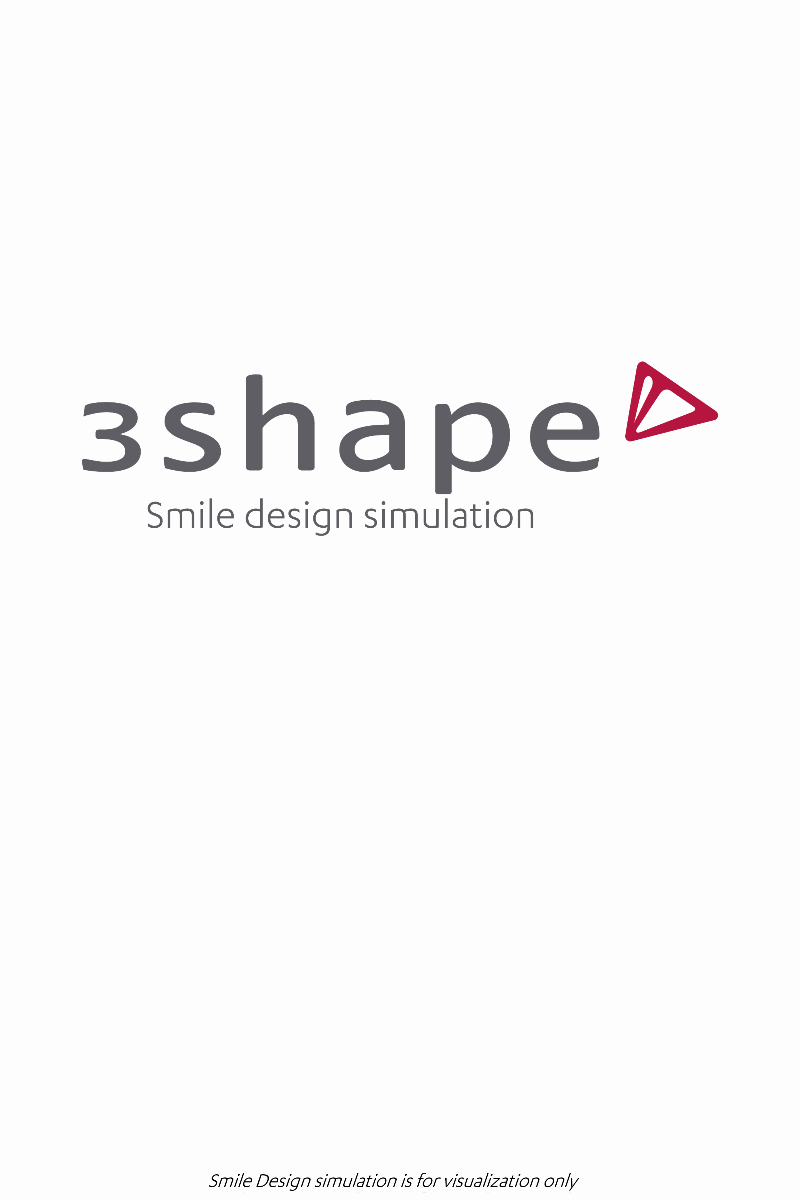 【美白貼片】有關於我的牙齒🦷終於鼓起勇氣做了陶瓷貼片 為什麼要做?注意事項? (板橋蒔美牙醫 薛聖儒醫生) - 第18張圖 0629