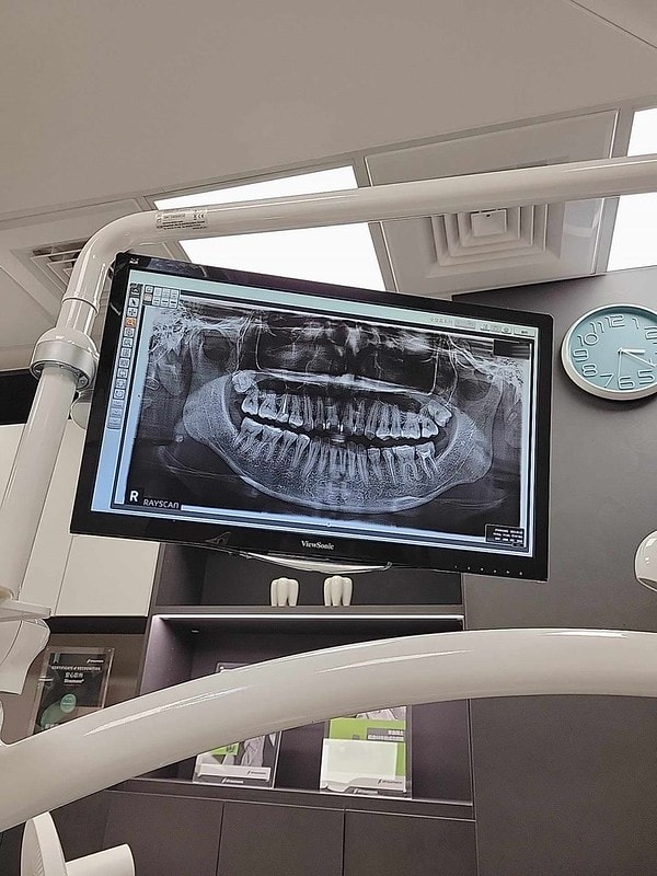 【美白貼片】有關於我的牙齒🦷終於鼓起勇氣做了陶瓷貼片 為什麼要做?注意事項? (板橋蒔美牙醫 薛聖儒醫生) - 第20張圖 433899312_1509606359988280_2501899171388213094_n