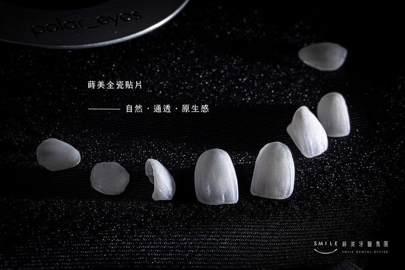 【美白貼片】有關於我的牙齒🦷美白貼片過程記錄 還有更多BA照(板橋蒔美牙醫 薛聖儒醫生) - 第4張圖 蒔美全瓷貼片-自然通透原生感