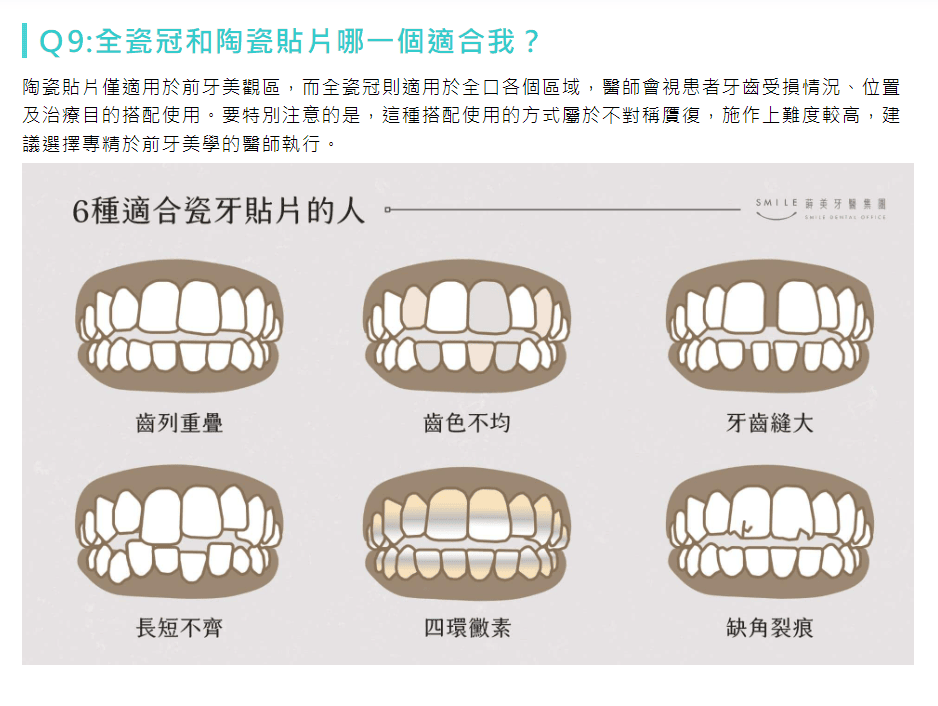 【美白貼片】有關於我的牙齒🦷美白貼片過程記錄 還有更多BA照(板橋蒔美牙醫 薛聖儒醫生) - 第3張圖 【美白貼片】有關於我的牙齒🦷美白貼片過程記錄 還有更多BA照(板橋蒔美牙醫 薛聖儒醫生)