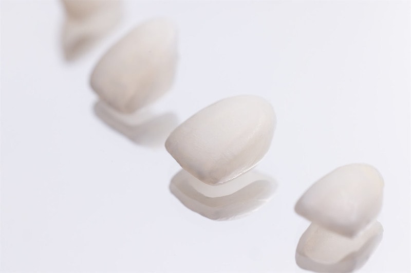 【美白貼片】有關於我的牙齒🦷美白貼片過程記錄 還有更多BA照(板橋蒔美牙醫 薛聖儒醫生) - 第5張圖 _83A0008-Enhanced-NR