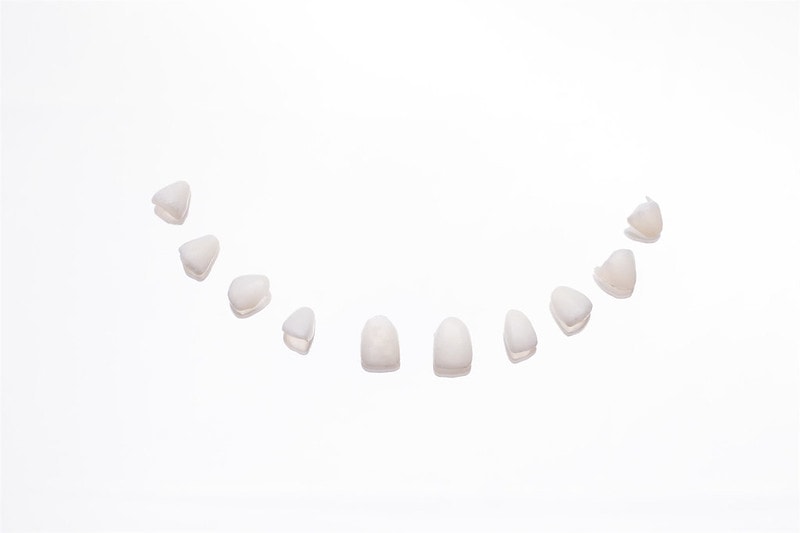 【美白貼片】有關於我的牙齒🦷美白貼片過程記錄 還有更多BA照(板橋蒔美牙醫 薛聖儒醫生) - 第7張圖 _83A0005