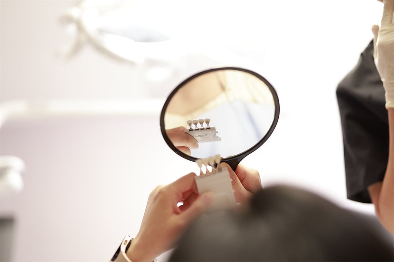 【美白貼片】有關於我的牙齒🦷美白貼片過程記錄 還有更多BA照(板橋蒔美牙醫 薛聖儒醫生) - 第13張圖 _83A0242