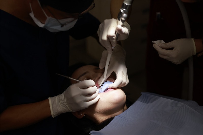 【美白貼片】有關於我的牙齒🦷美白貼片過程記錄 還有更多BA照(板橋蒔美牙醫 薛聖儒醫生) - 第21張圖 _83A0107